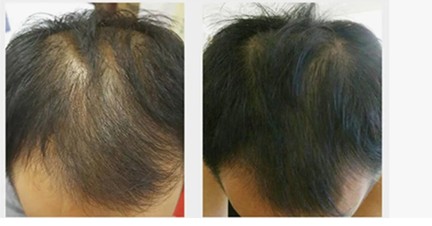 Hair Max Flip 80 Laser Cap 02